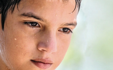 Çocuklarda Aşırı Terleme Neden Olur?